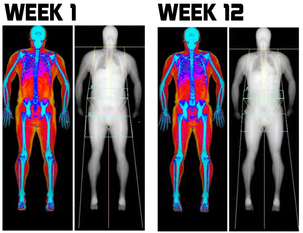 What A DEXA Scan Can Tell You About Your Longevity